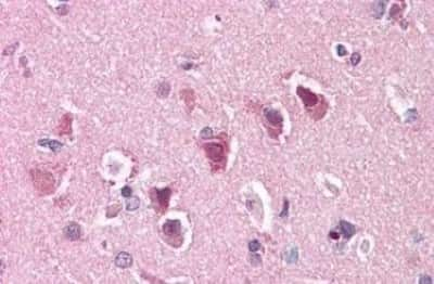 Immunohistochemistry-Paraffin: ENT1 Antibody [NBP3-14311]